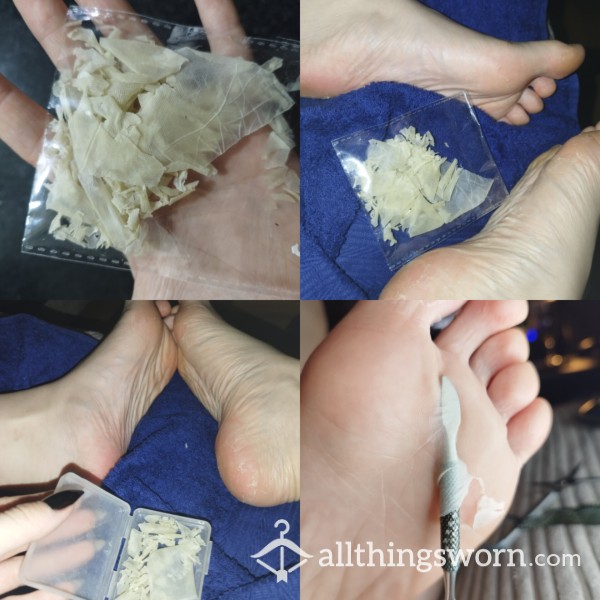 BIG PACKAGE - Massive Crunchy Foot Peels + Full Drive Of Pics & Videos Of Foot Peeling!