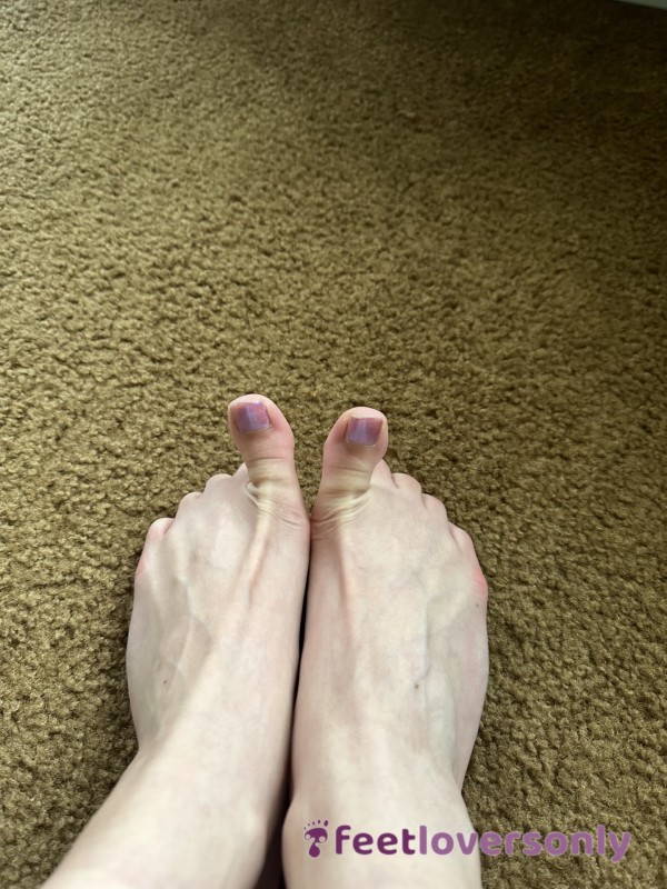 Feet After A Long Day Of Work/standing