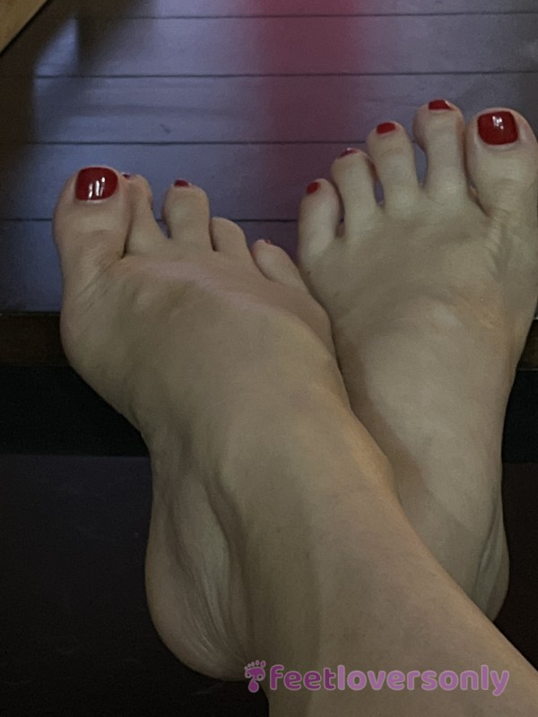 Feet Before Pedicure