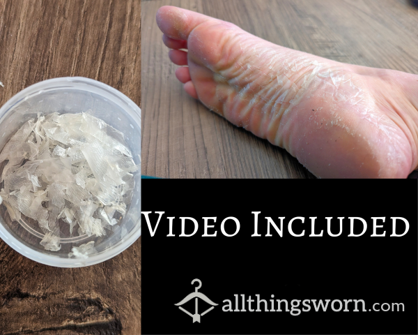 Foot Peelings + Video 🎥