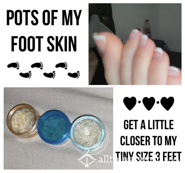 Foot Skin Pots🦶🏻