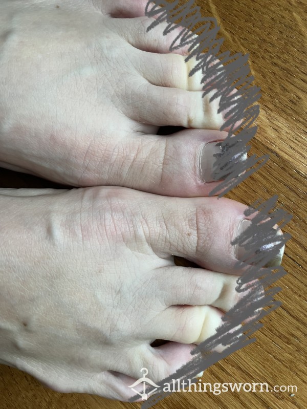My Toe Nails Have Been So Neglected, They Are Longer Than My Fingernails