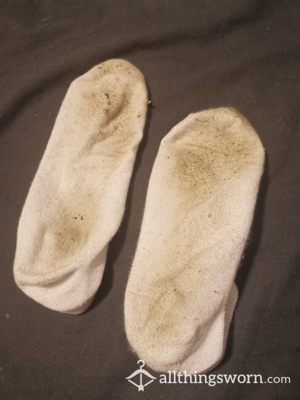 Smelly Not So White Socks 🤤🧀🧂