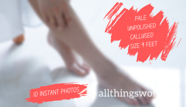 Pale Unpolished Callused Size 9 Feet | 10 Photos