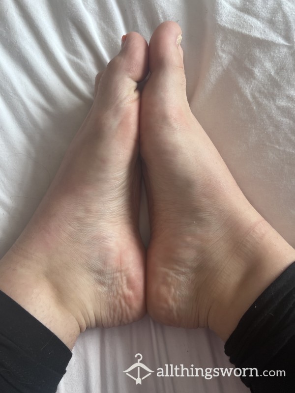 Photos Of My Feet With & Without Socks 🦶🏻🦶🏻