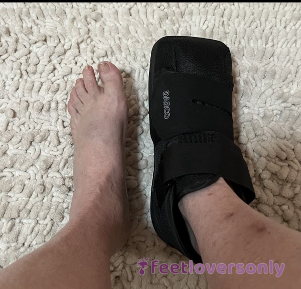 Post-surgical Foot After Virtual Hiking And Running Into An Unfriendly Bantha On Tatooine.