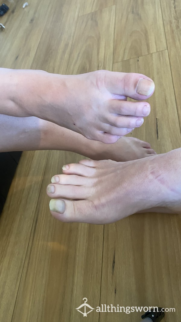 Sisters Long Toenails, Toenail Clipping, Nails And Feet A Little Bit Dirty, 10 X Pictures