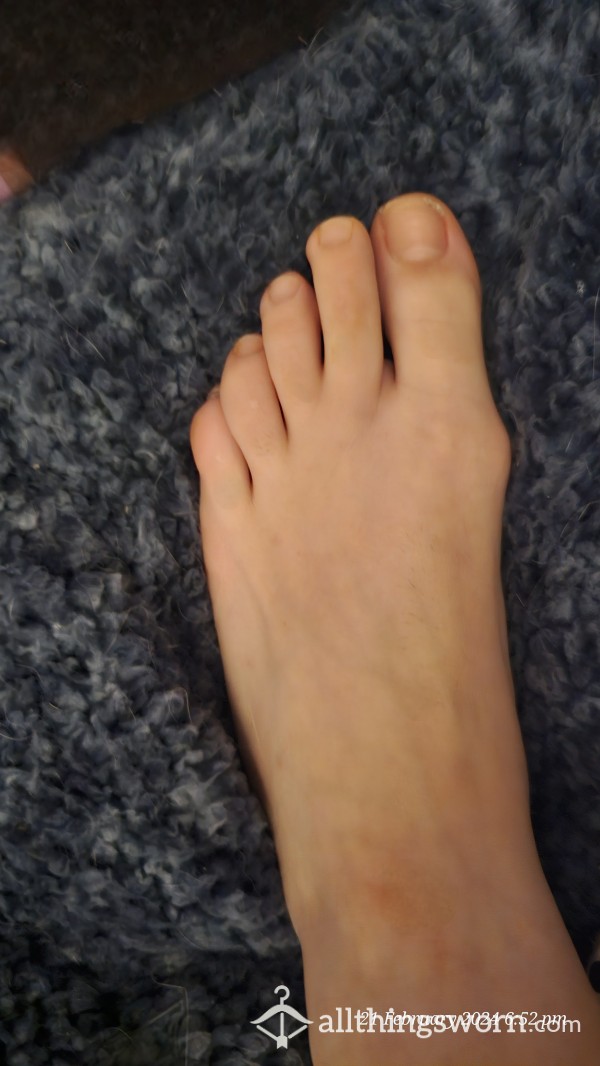 Unmanicured Cheeky Foot Picture