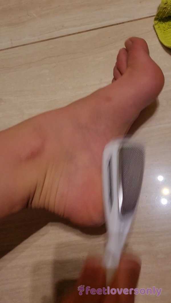 Watch Me Abuse My Feet With The File! I'm Not Easy On Them, Scrubing My Dry Hard Skin!